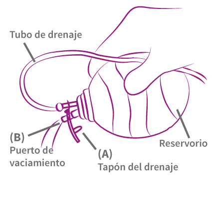 Sistema de drenaje cancer de mama